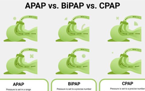 What’s the Difference Between a CPAP, APAP, and BiPAP Machine?