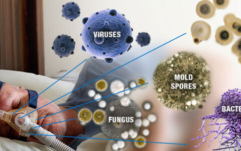 The Best Way to Clean Your Home CPAP Machine